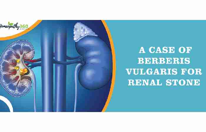 Berberis Vulgaris Homeopathic Medicine (2)