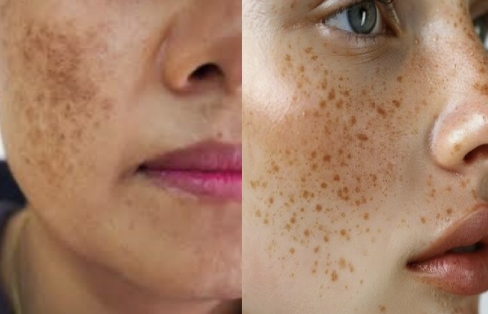 Pigmentation Write for Us