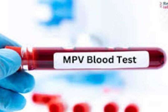 MPV Blood Test