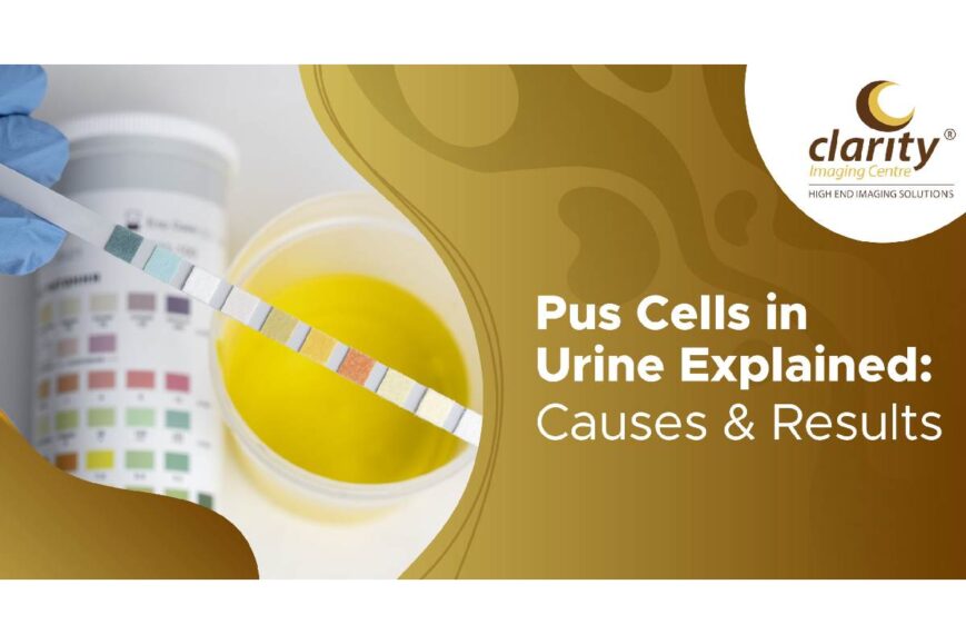 pus cells in urine