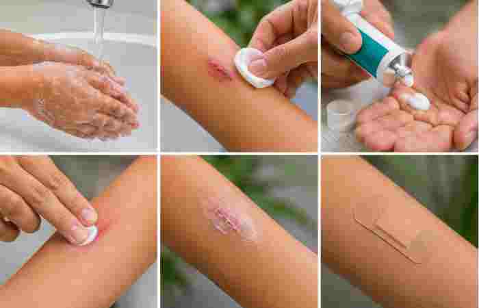 how fradiomycin skin cream is usually Applied